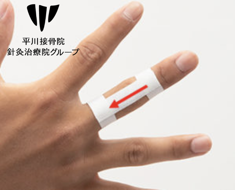 ばね指のテーピング