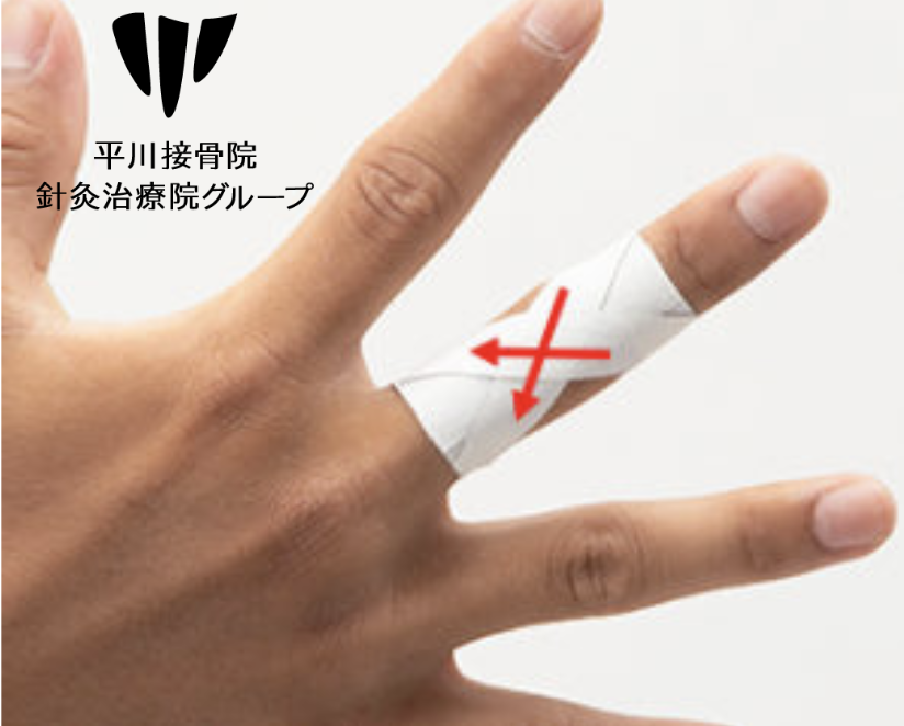 ばね指テーピングクロスに巻く