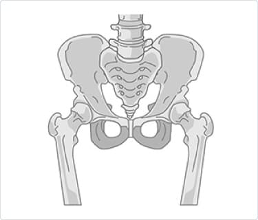 股関節痛
