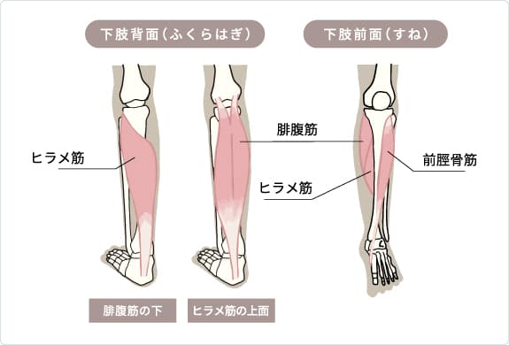 シンスプリント
