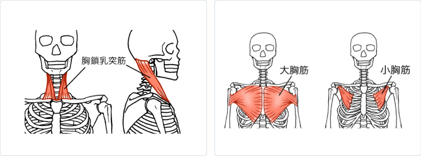 ストレートネック